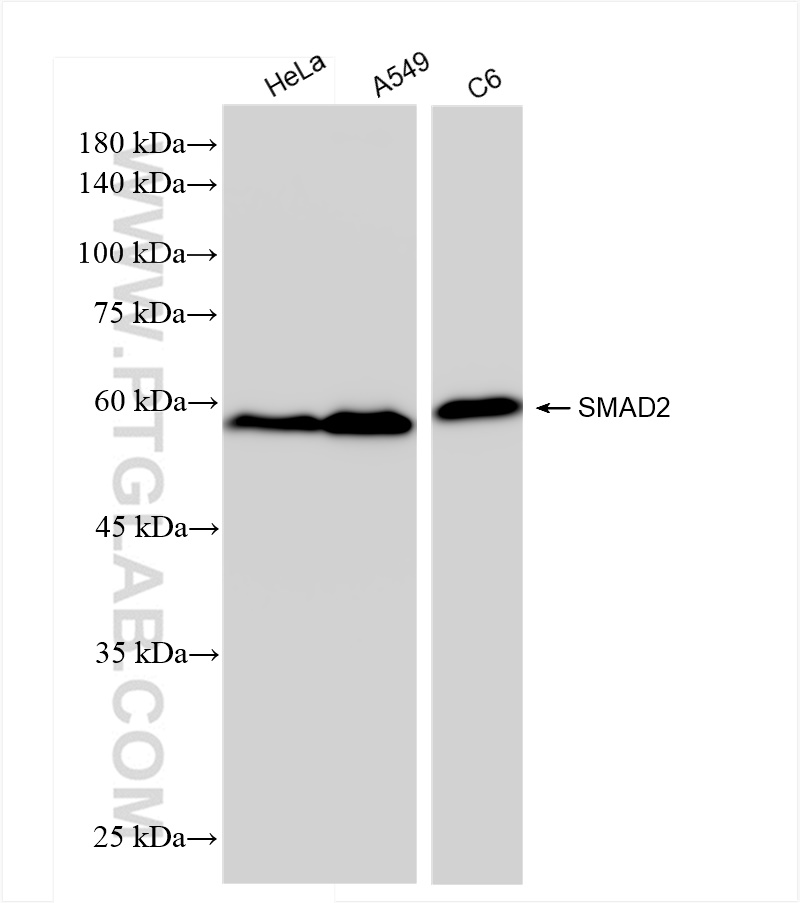 Western Blot (WB) analysis of various lysates using SMAD2 Recombinant antibody (83841-5-RR)