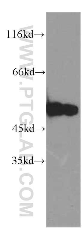 Western Blot (WB) analysis of HEK-293 cells using SMAD3 Polyclonal antibody (51145-1-AP)