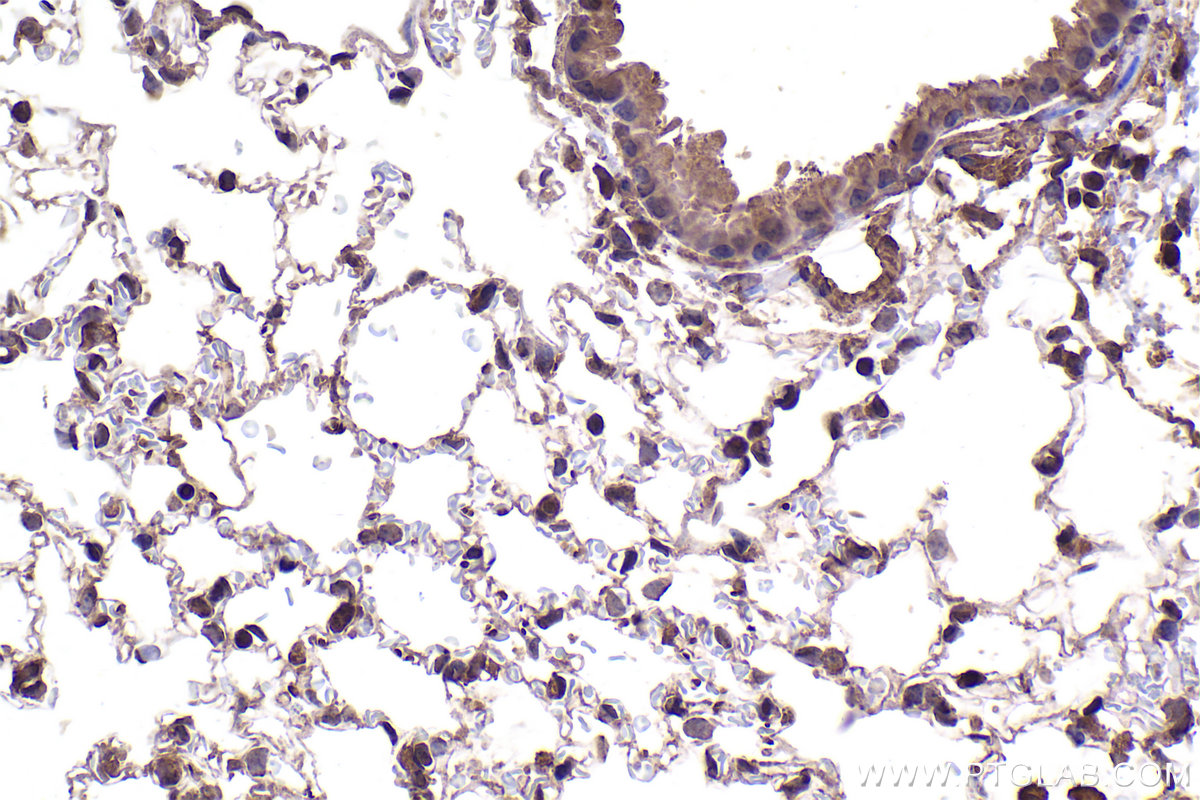 Immunohistochemistry (IHC) staining of mouse lung tissue using SMAD3 Monoclonal antibody (66516-1-Ig)