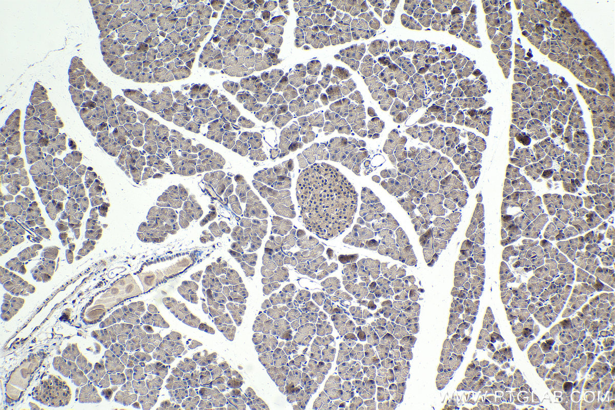 Immunohistochemistry (IHC) staining of mouse pancreas tissue using SMAD4 Polyclonal antibody (10231-1-AP)