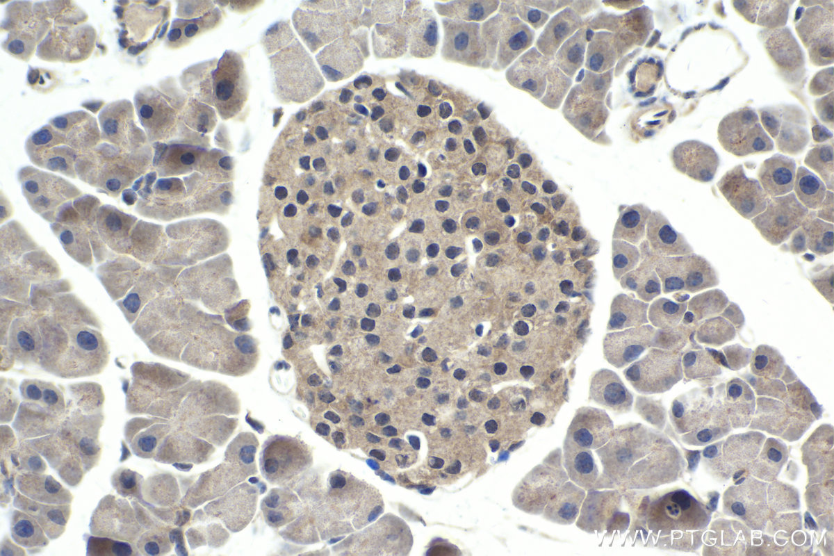 Immunohistochemistry (IHC) staining of mouse pancreas tissue using SMAD4 Polyclonal antibody (10231-1-AP)