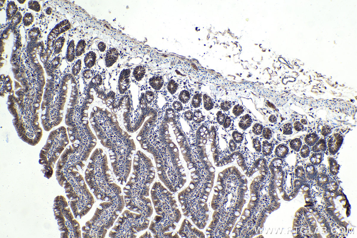 Immunohistochemistry (IHC) staining of rat small intestine tissue using SMAD4 Polyclonal antibody (10231-1-AP)