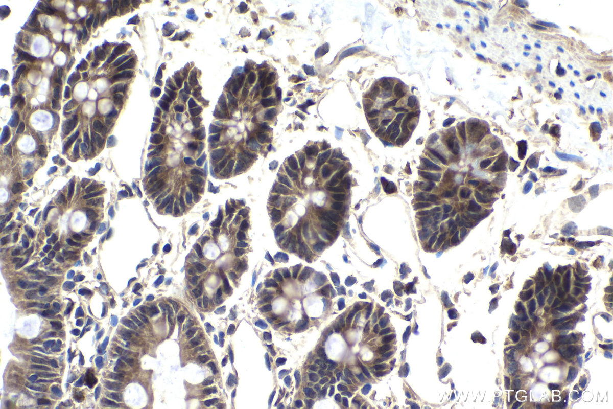 Immunohistochemistry (IHC) staining of rat small intestine tissue using SMAD4 Polyclonal antibody (10231-1-AP)