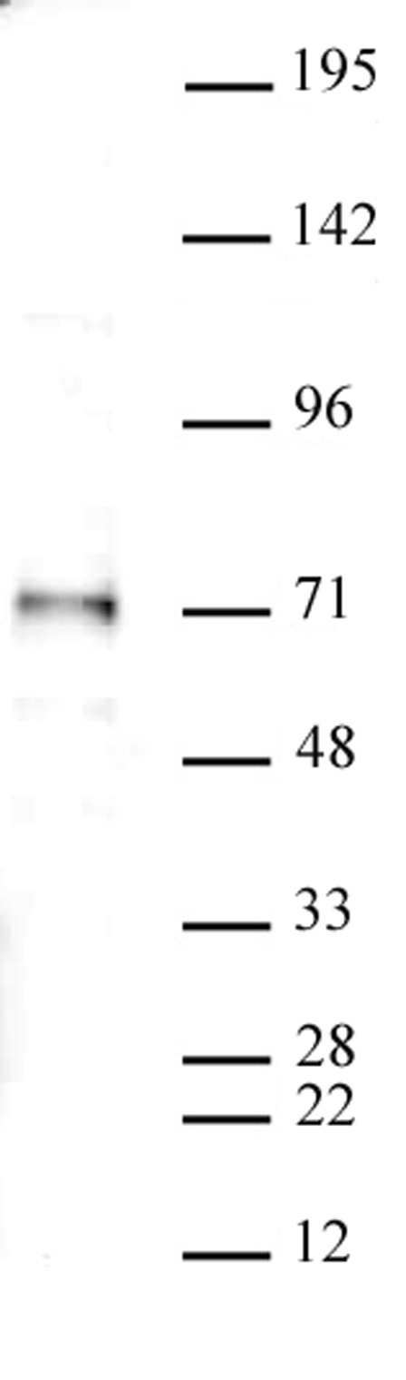 SMAD4 antibody (pAb) tested by Western blot. Detection of SMAD4 by Western blot analysis. Nuclear extract of HeLa cells (30 ug) probed with SMAD4 antibody at a dilution of 1:500.