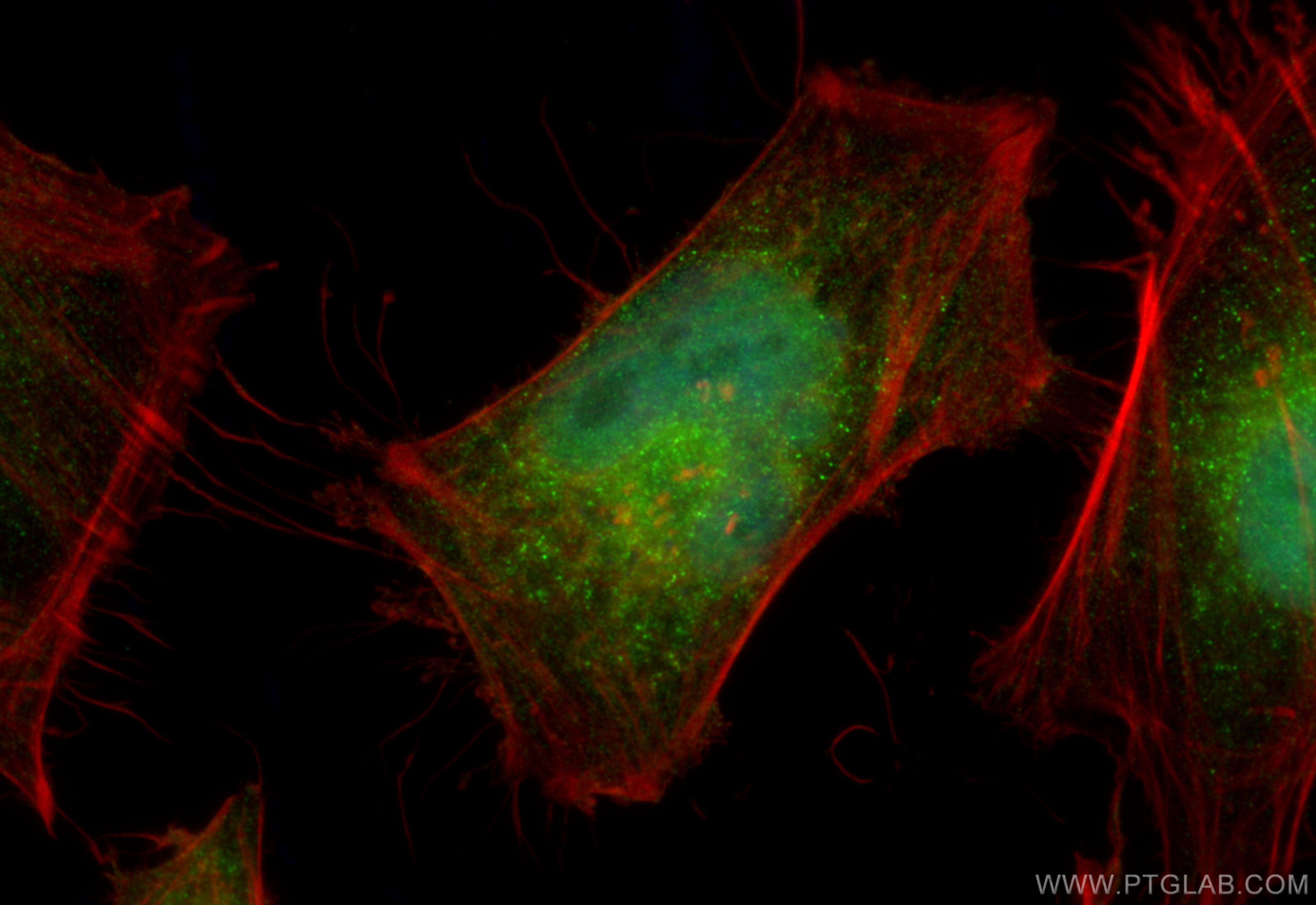 Immunofluorescence (IF) / fluorescent staining of HeLa cells using SMAD5 Polyclonal antibody (12167-1-AP)