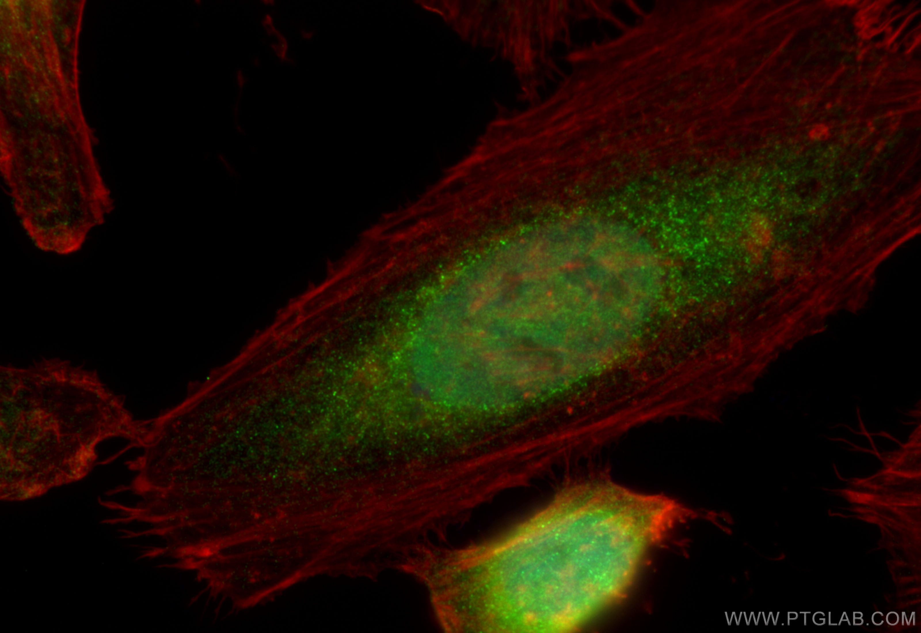 Immunofluorescence (IF) / fluorescent staining of HeLa cells using SMAD5 Polyclonal antibody (12167-1-AP)