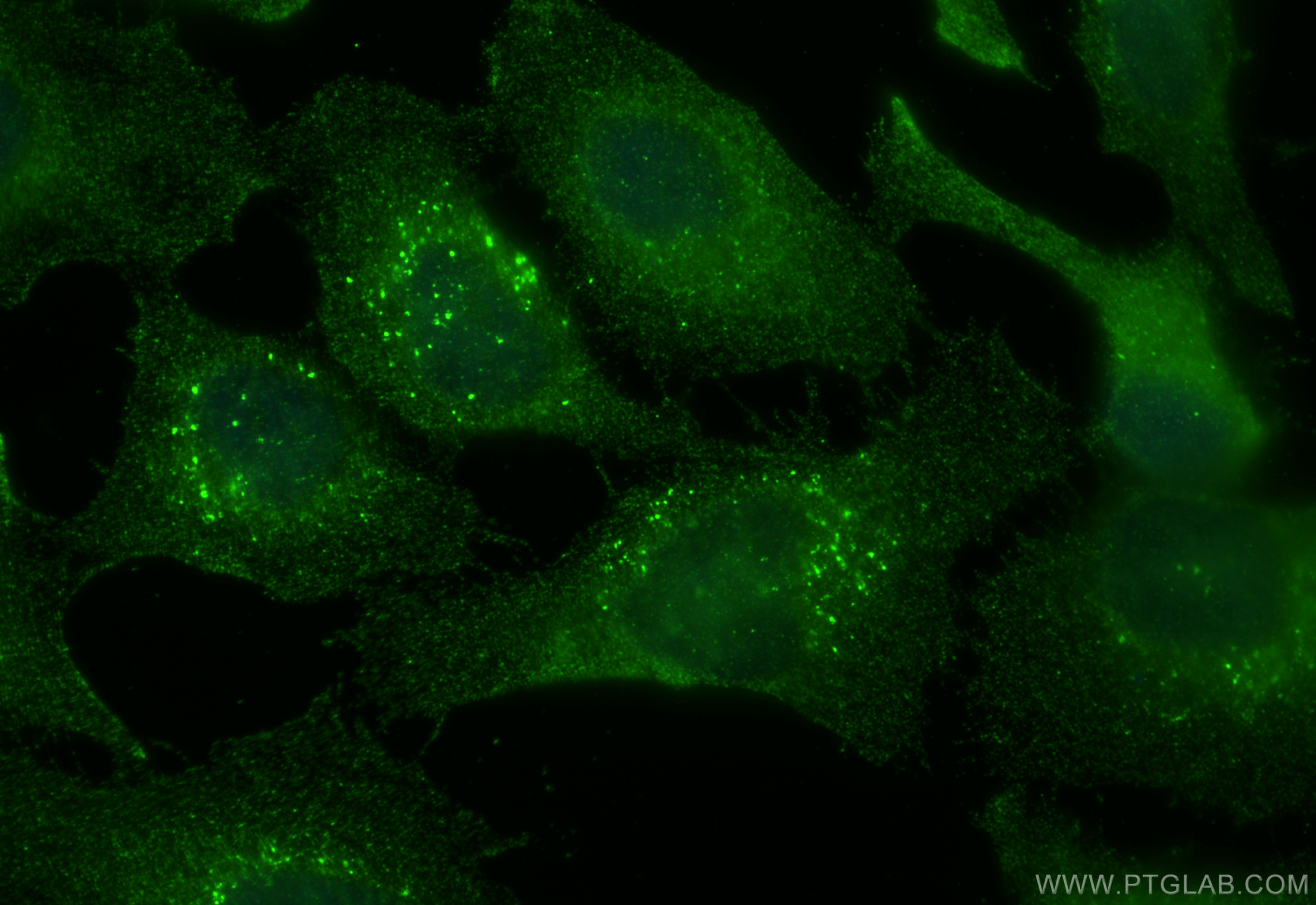 Immunofluorescence (IF) / fluorescent staining of HeLa cells using SMAD7 Monoclonal antibody (68594-1-Ig)