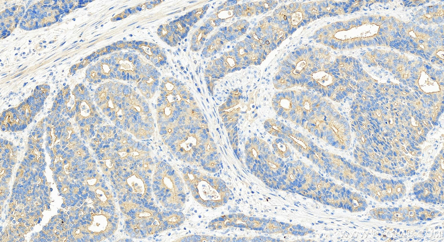 Immunohistochemistry (IHC) staining of human stomach tissue using SMAP1 Polyclonal antibody (12799-1-AP)