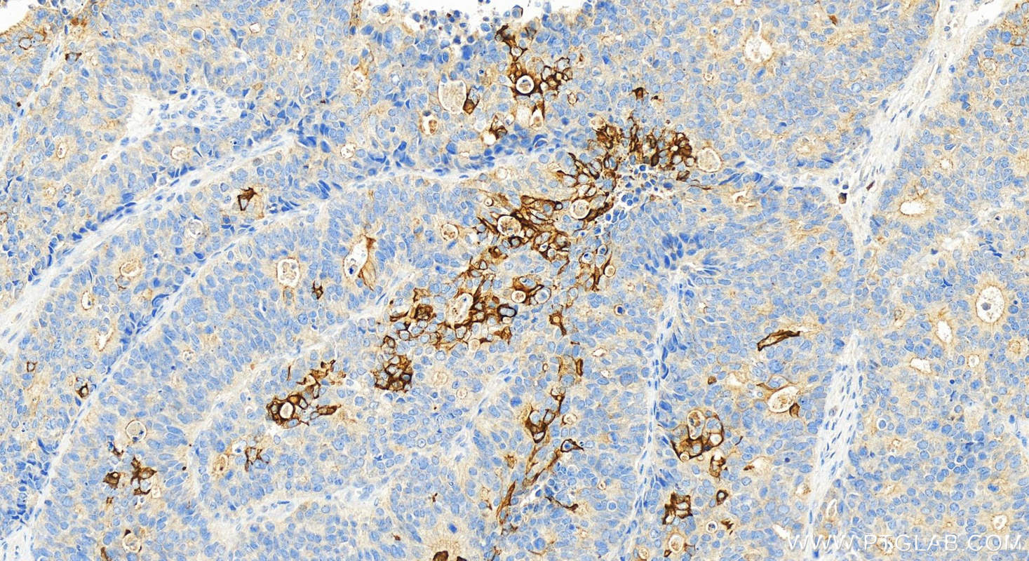 Immunohistochemistry (IHC) staining of human stomach tissue using SMAP1 Polyclonal antibody (12799-1-AP)