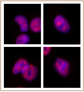 SMARCA2 / BRM antibody (mAb) tested by Immunofluorescence. Formaldehyde fixed HeLa cells stained with SMARCA2 / BRM antibody at a 0.5 ug/ml dilution.