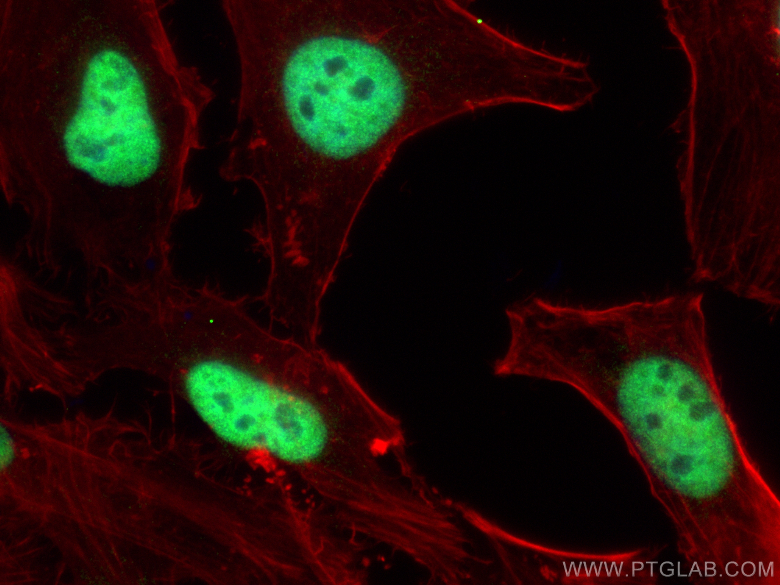 Immunofluorescence (IF) / fluorescent staining of HeLa cells using SMARCA2-Specific Polyclonal antibody (26613-1-AP)