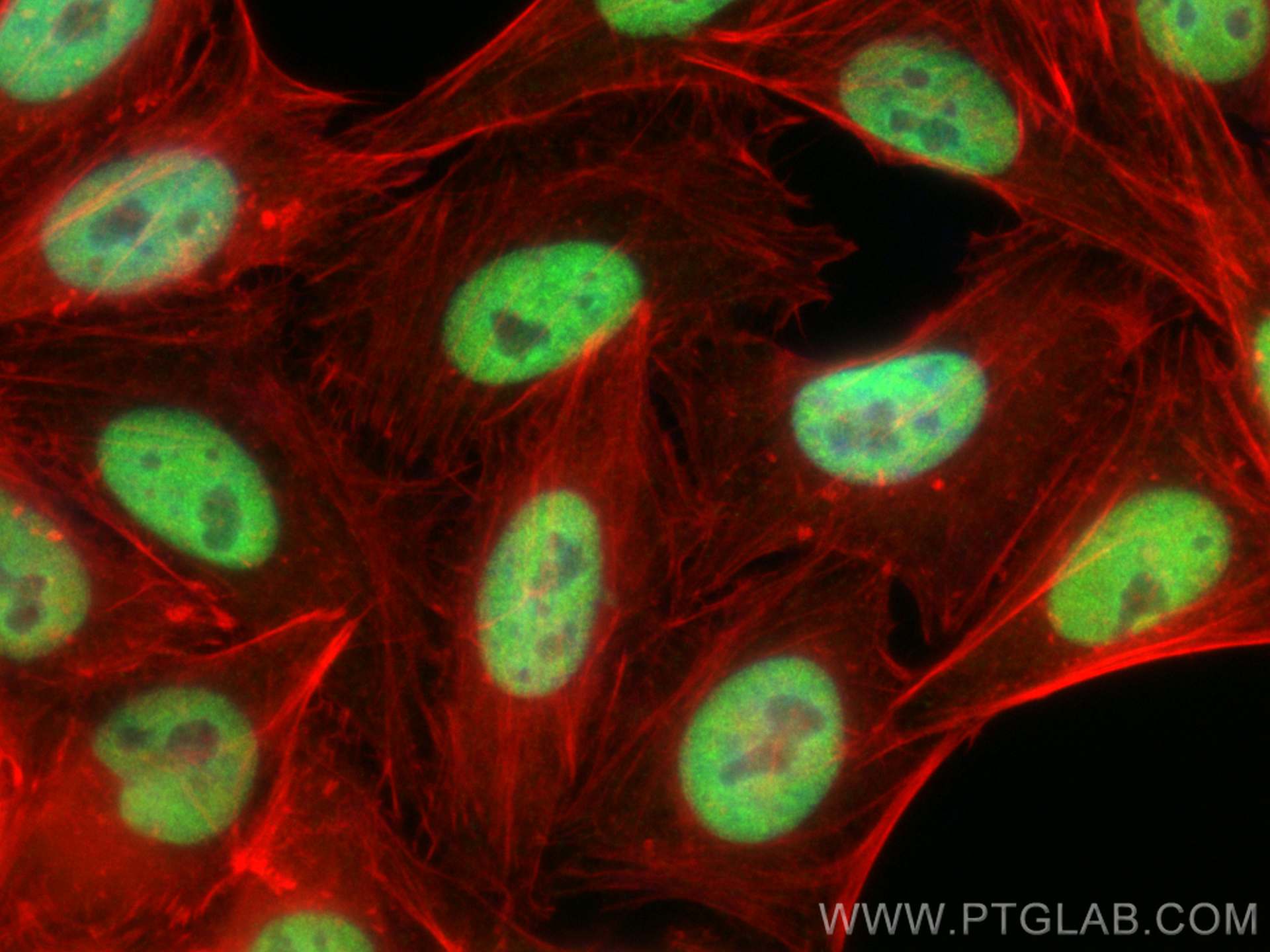 Immunofluorescence (IF) / fluorescent staining of HepG2 cells using SMARCA4/BRG1 Polyclonal antibody (21634-1-AP)