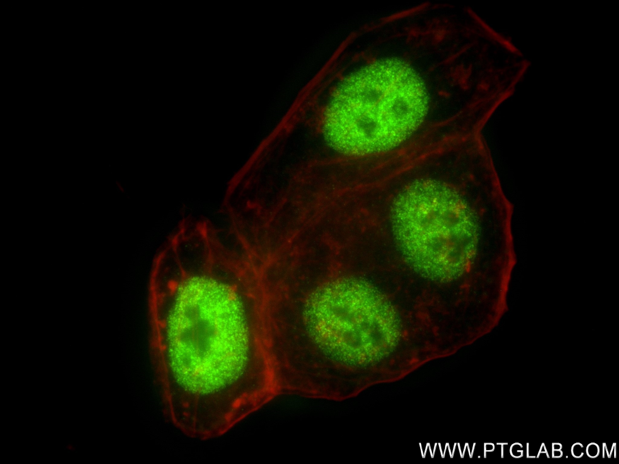 Immunofluorescence (IF) / fluorescent staining of HepG2 cells using SMARCA4 Recombinant antibody (83310-2-RR)