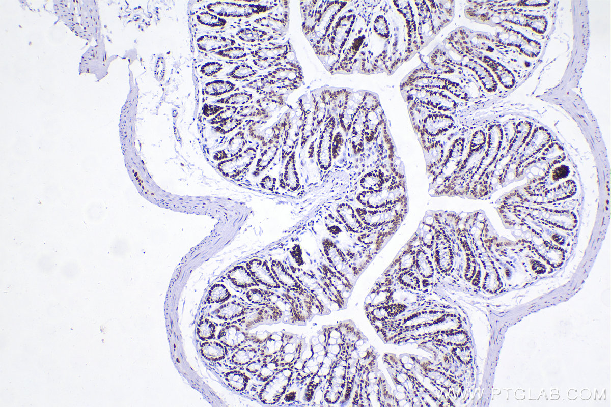 Immunohistochemistry (IHC) staining of mouse colon tissue using SMARCA4 Recombinant antibody (83310-2-RR)