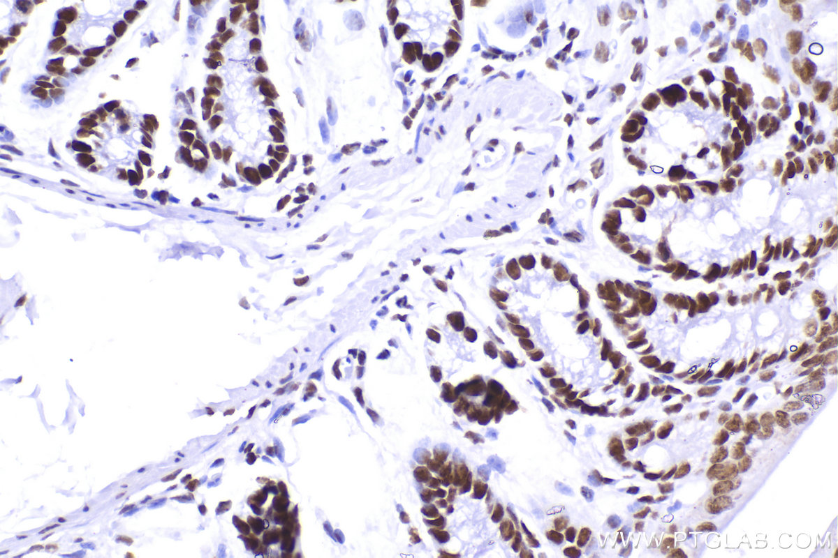 Immunohistochemistry (IHC) staining of mouse colon tissue using SMARCA4 Recombinant antibody (83310-2-RR)