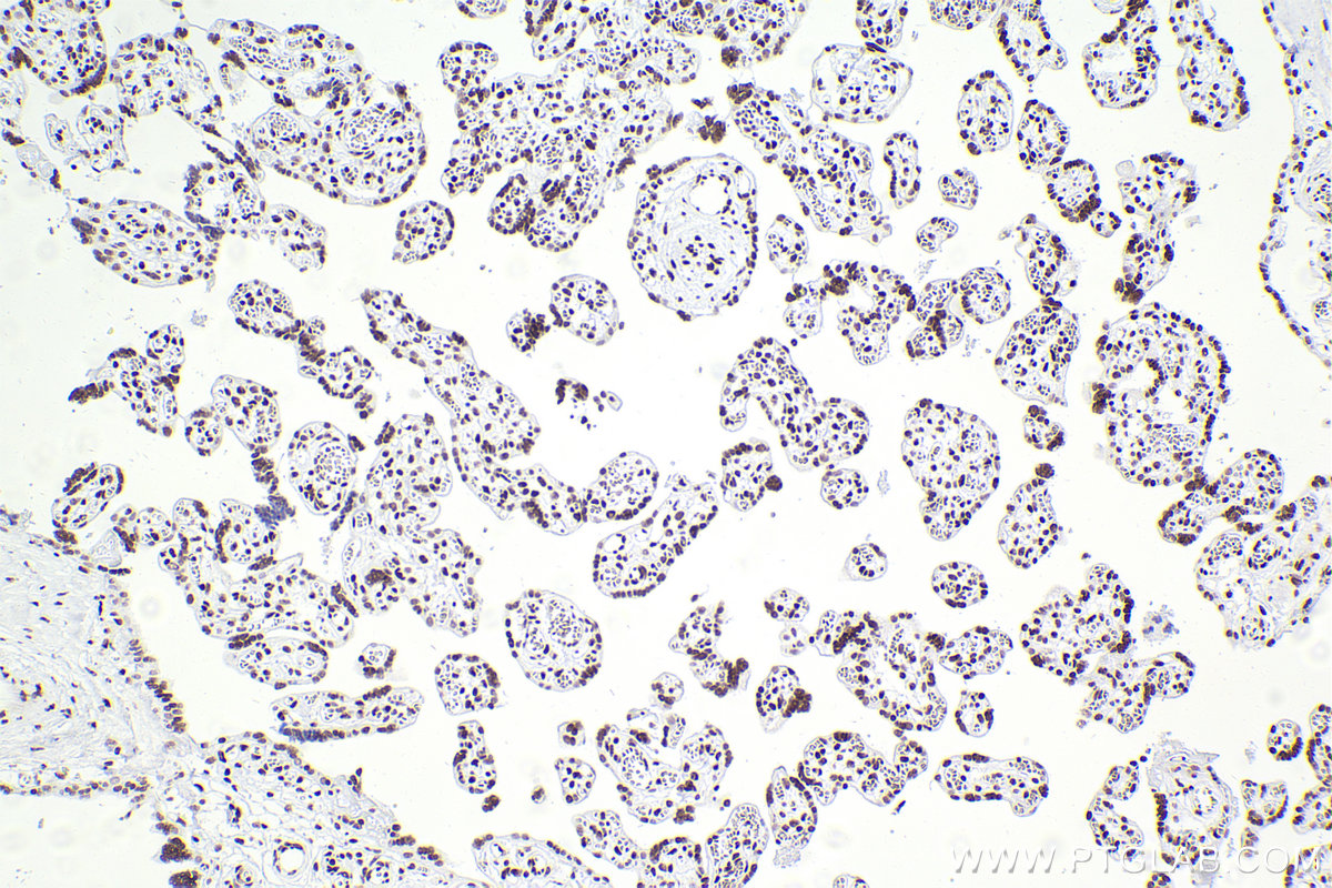 Immunohistochemistry (IHC) staining of human placenta tissue using SMARCA4 Recombinant antibody (83310-2-RR)