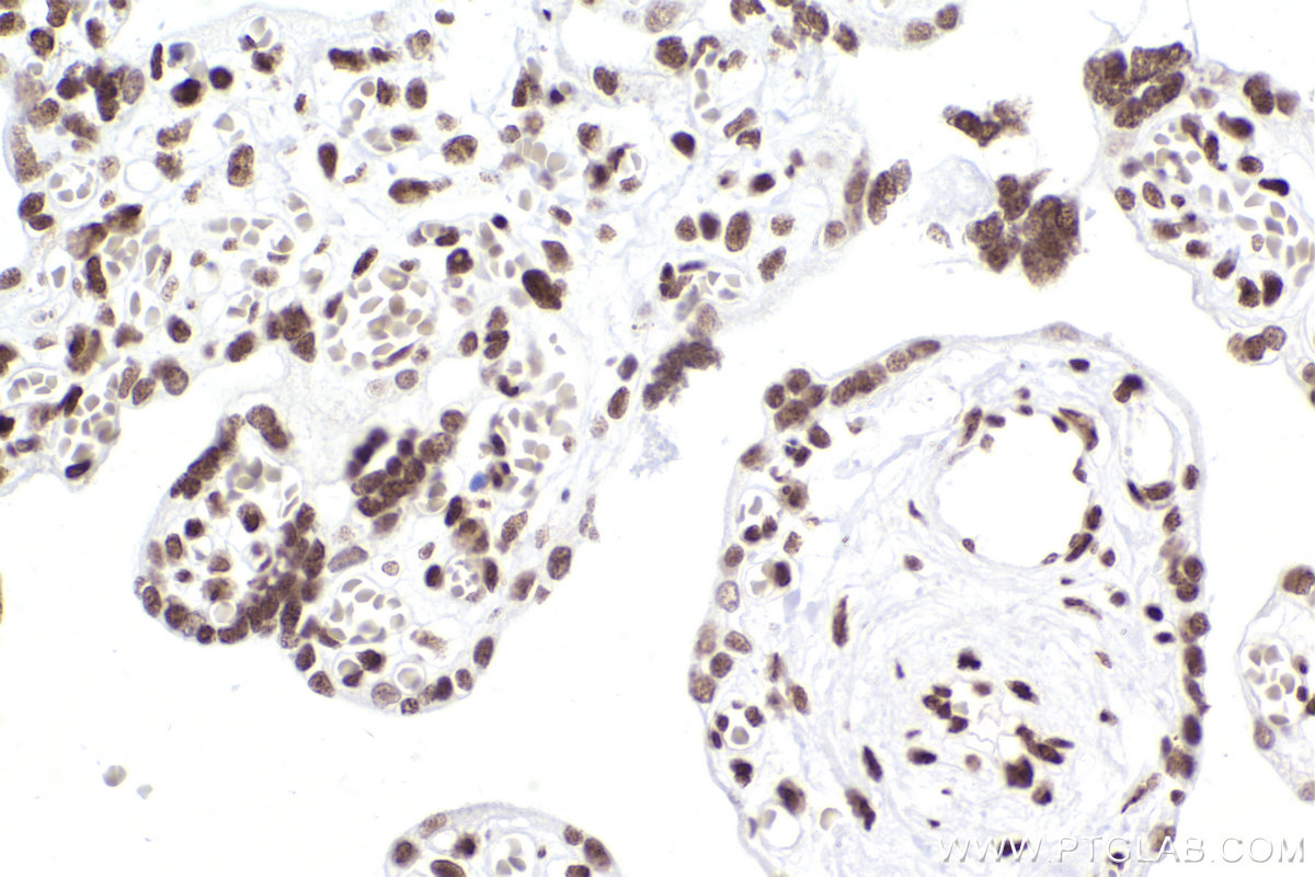 Immunohistochemistry (IHC) staining of human placenta tissue using SMARCA4 Recombinant antibody (83310-2-RR)