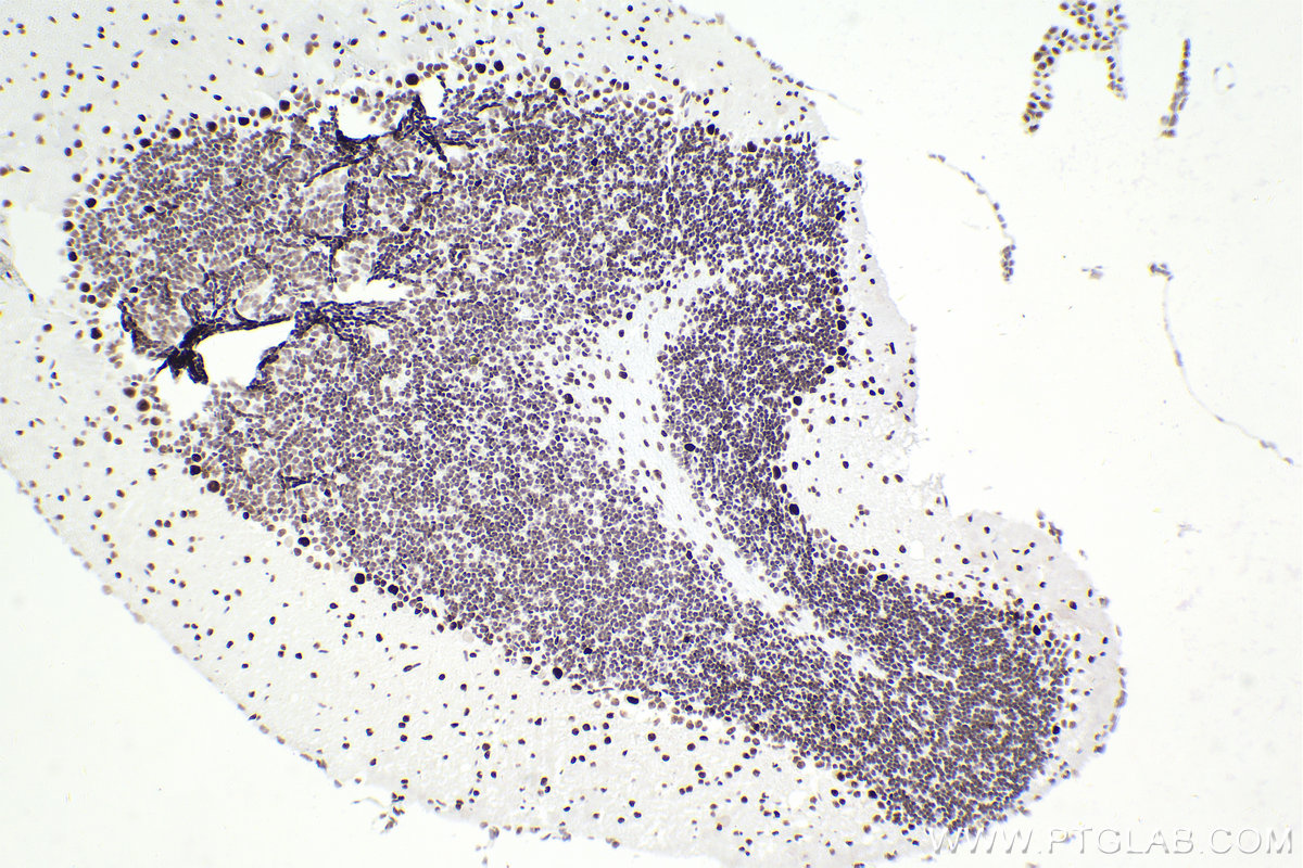 Immunohistochemistry (IHC) staining of mouse cerebellum tissue using SMARCA4 Recombinant antibody (83310-2-RR)