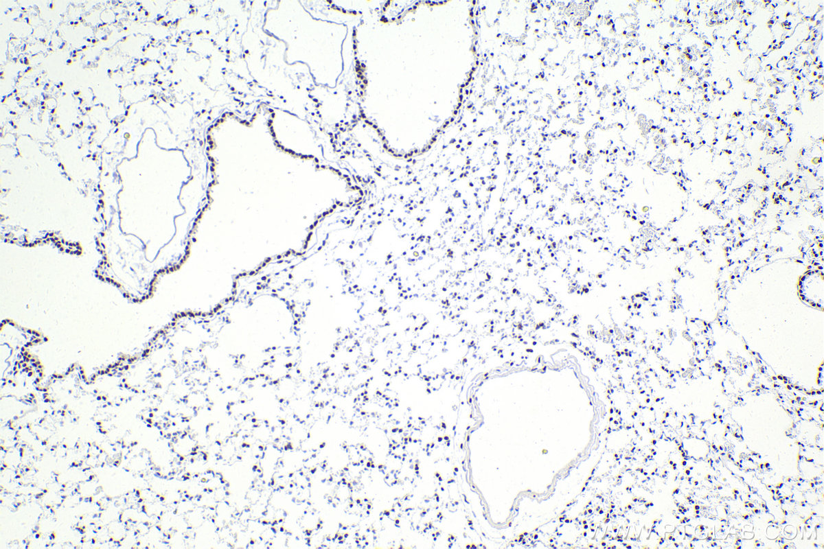 Immunohistochemistry (IHC) staining of mouse lung tissue using SMARCA4 Recombinant antibody (83310-2-RR)