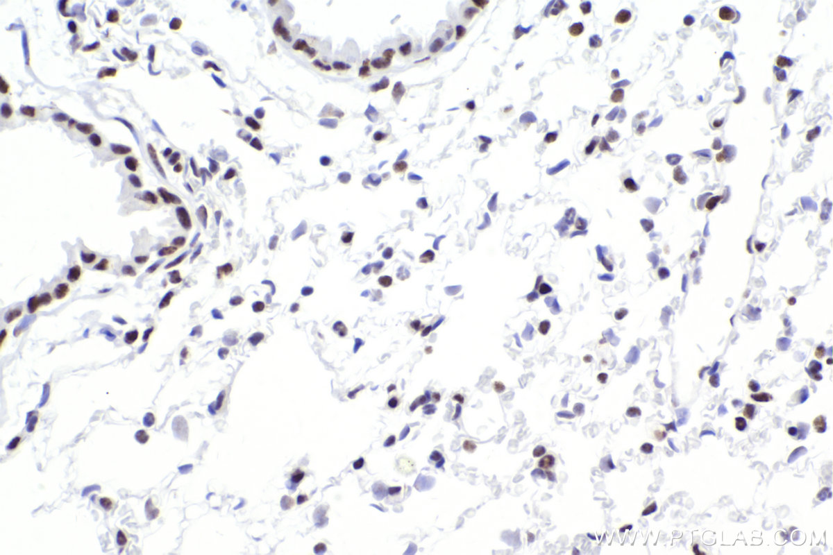 Immunohistochemistry (IHC) staining of mouse lung tissue using SMARCA4 Recombinant antibody (83310-2-RR)