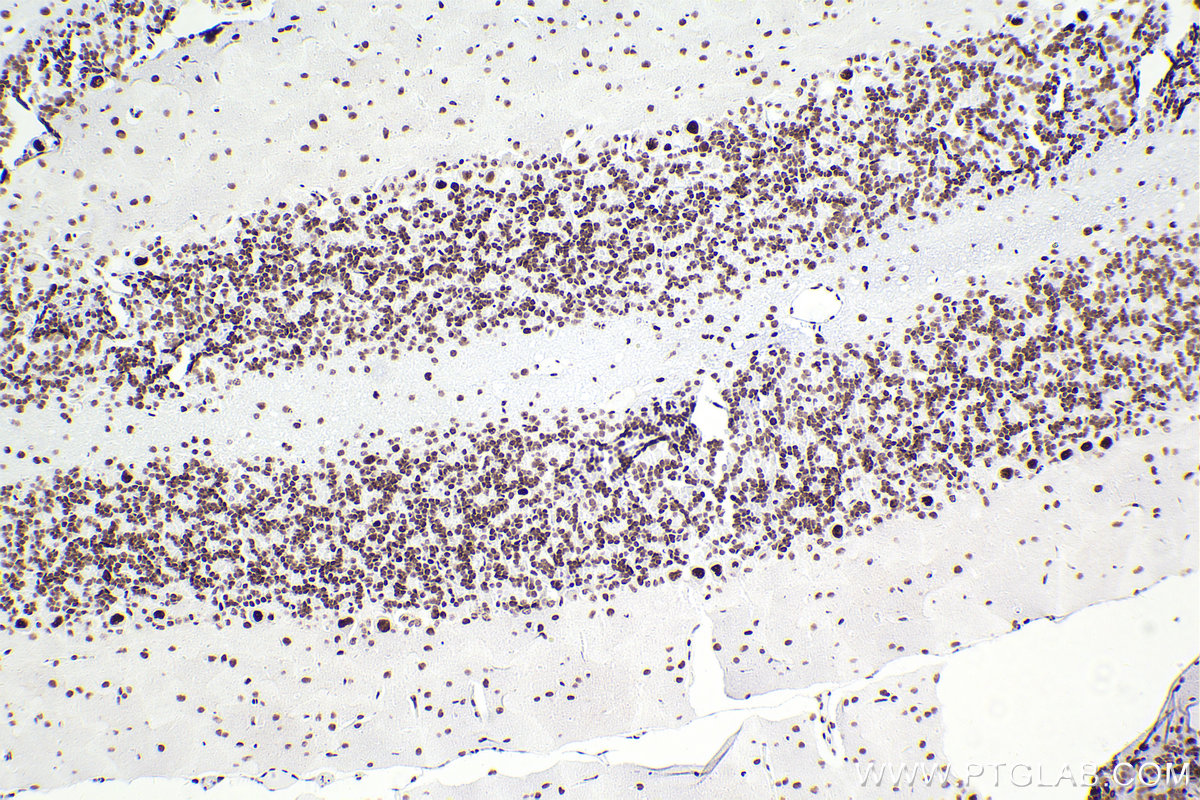 Immunohistochemistry (IHC) staining of rat cerebellum tissue using SMARCA4 Recombinant antibody (83310-2-RR)