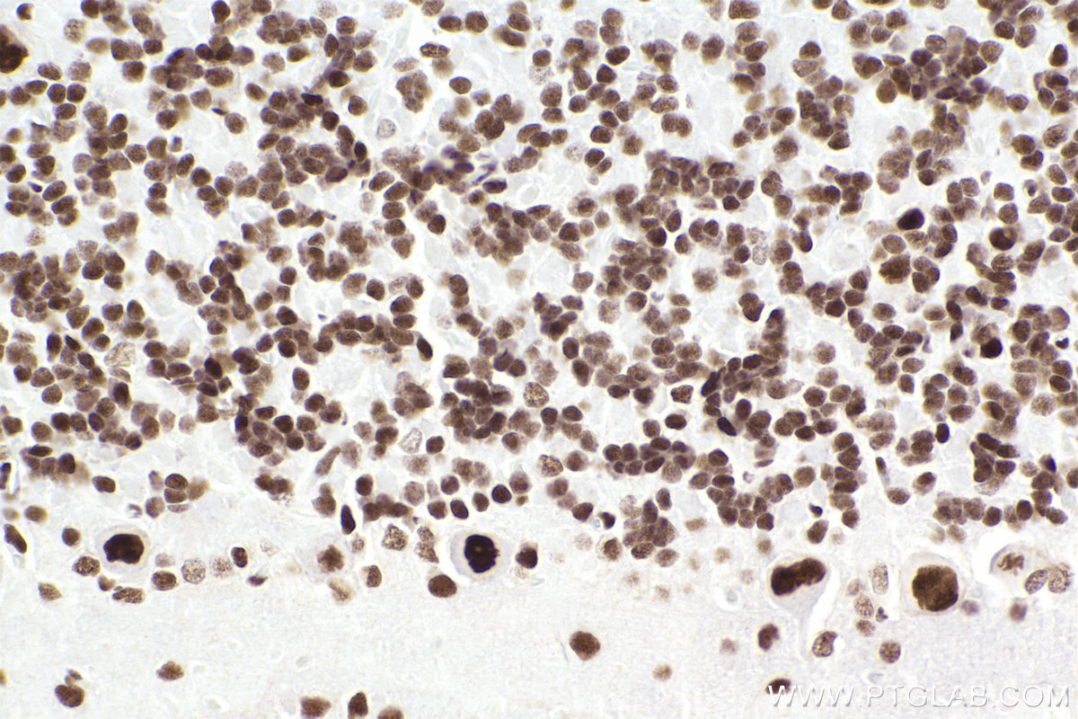 Immunohistochemistry (IHC) staining of rat cerebellum tissue using SMARCA4 Recombinant antibody (83310-2-RR)