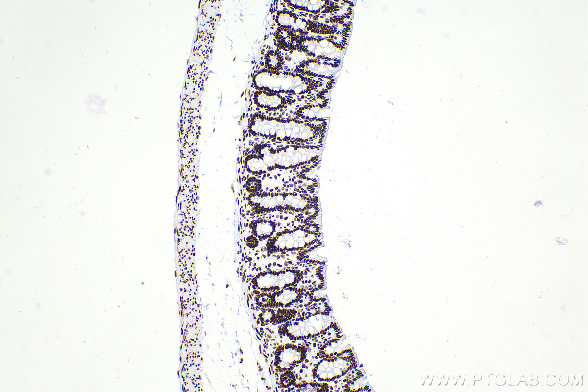 Immunohistochemistry (IHC) staining of rat colon tissue using SMARCA4 Recombinant antibody (83310-2-RR)