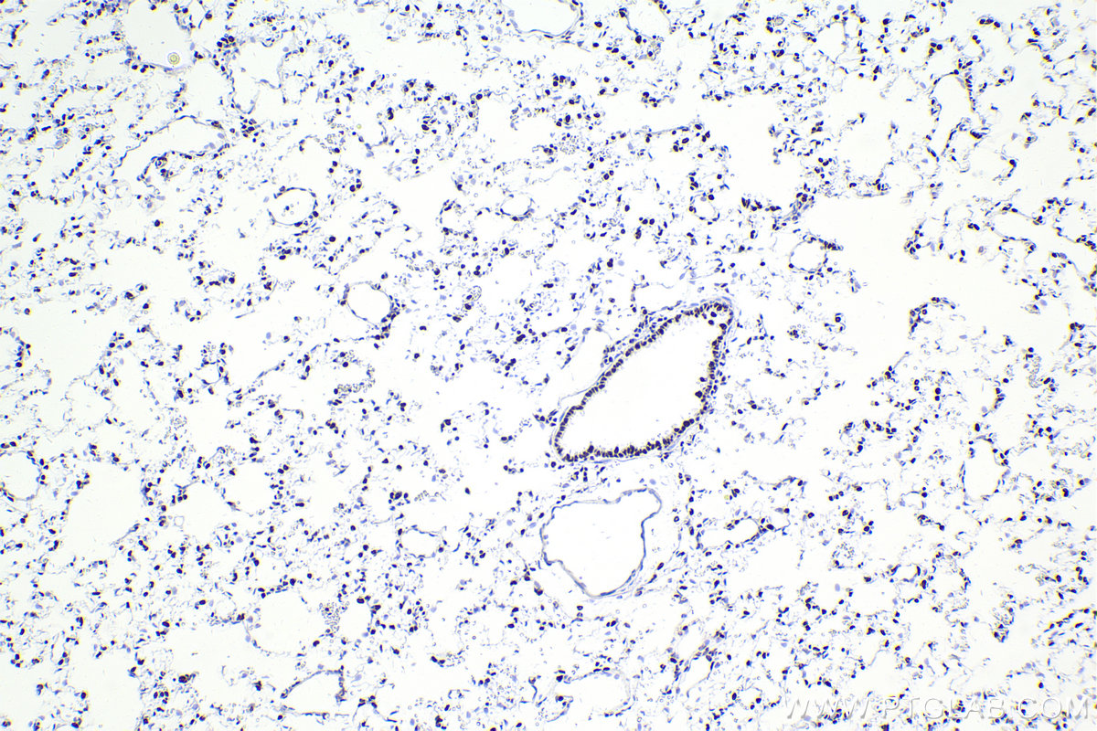 Immunohistochemistry (IHC) staining of rat lung tissue using SMARCA4 Recombinant antibody (83310-2-RR)