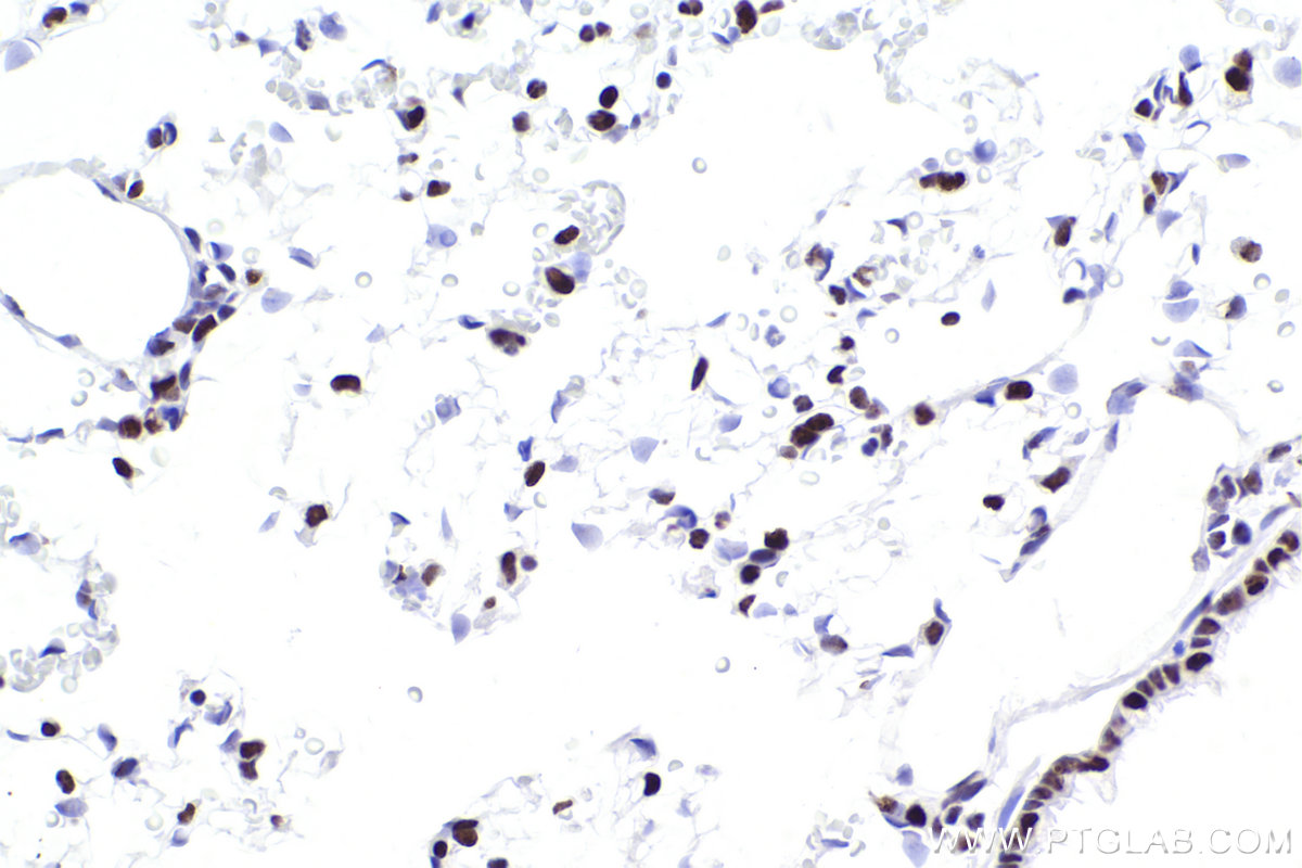 Immunohistochemistry (IHC) staining of rat lung tissue using SMARCA4 Recombinant antibody (83310-2-RR)