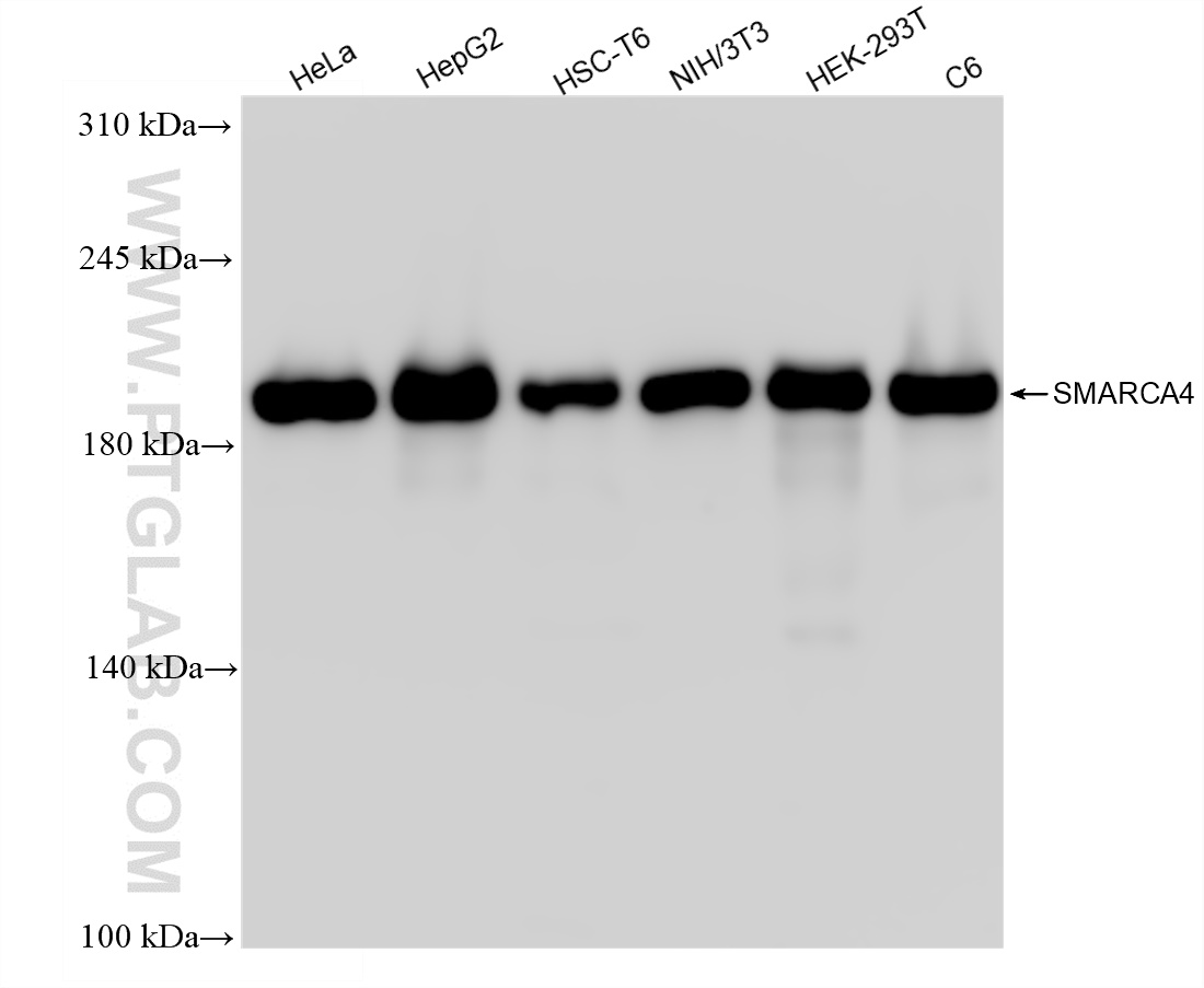 Western Blot (WB) analysis of various lysates using SMARCA4 Recombinant antibody (83310-2-RR)