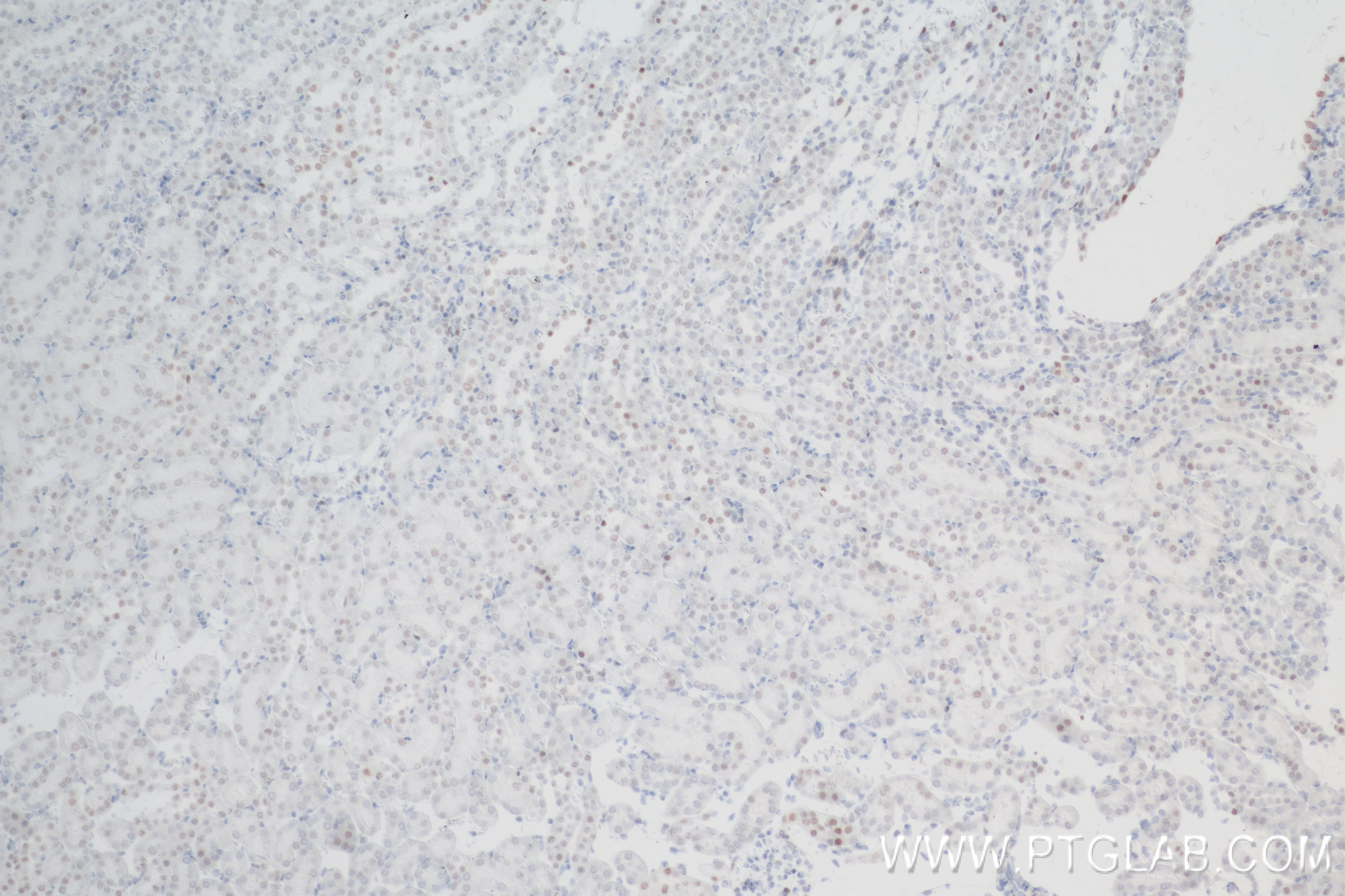 Immunohistochemistry (IHC) staining of mouse kidney tissue using SMARCA4 Recombinant antibody (83310-7-RR)