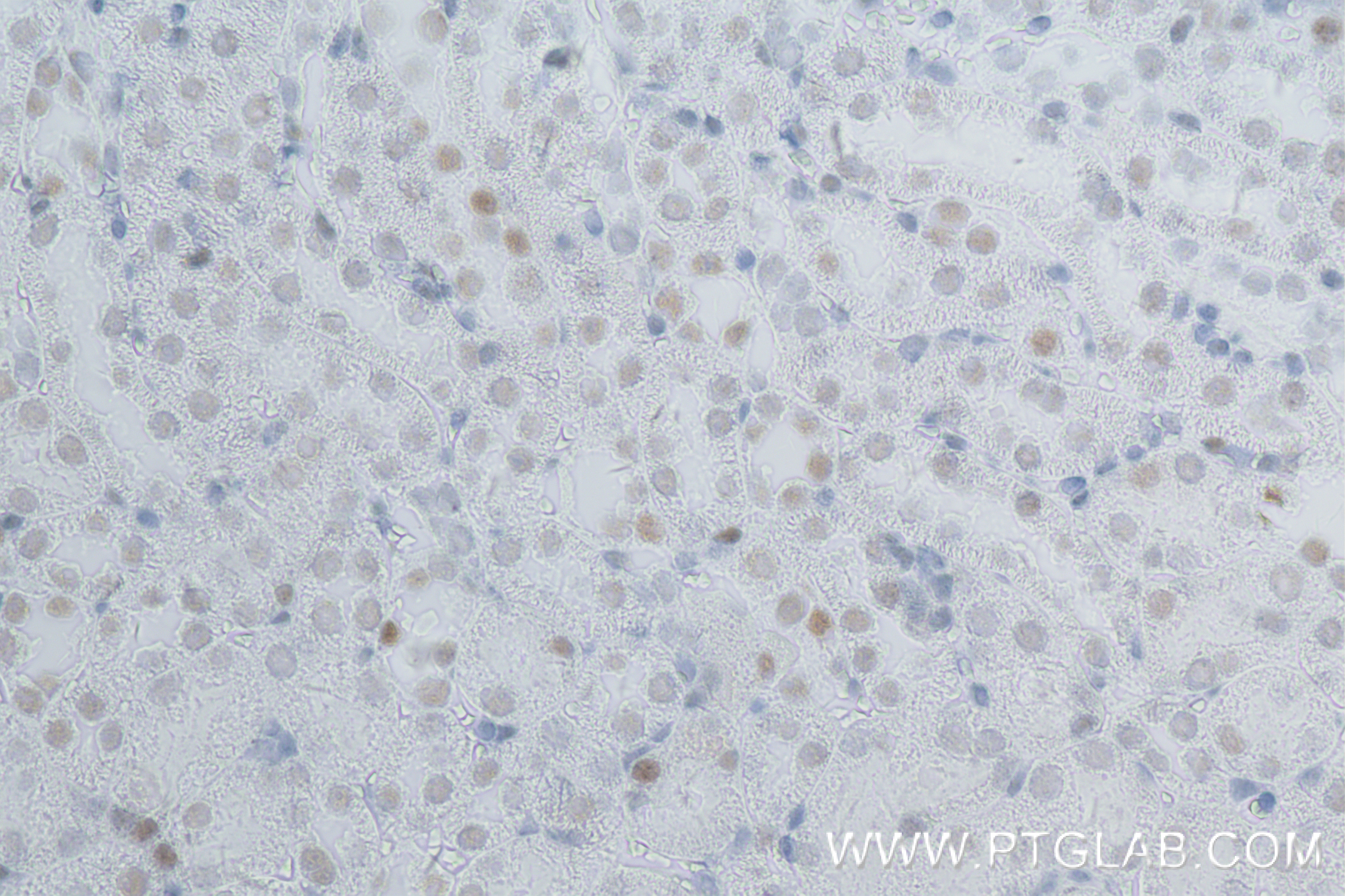 Immunohistochemistry (IHC) staining of mouse kidney tissue using SMARCA4 Recombinant antibody (83310-7-RR)