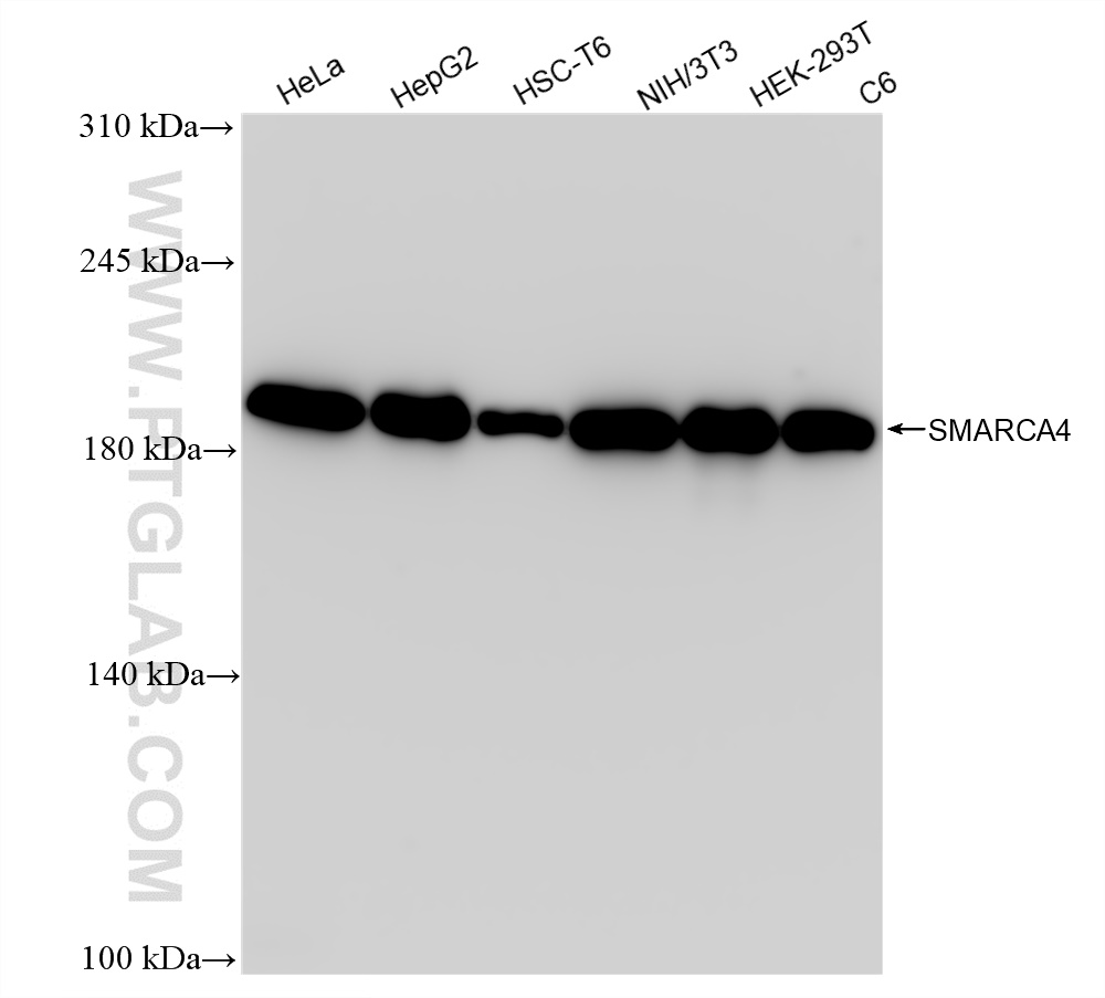 Western Blot (WB) analysis of various lysates using SMARCA4 Recombinant antibody (83310-7-RR)