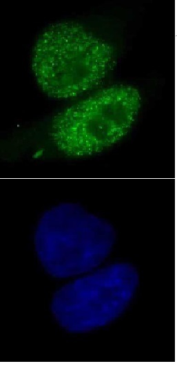 SMARCA4 antibody (mAb) (Clone 5B7) tested by immunofluorescence. Top: HeLa cells stained with SMARCA4 antibody (mAb). Bottom: Hoechst staining.