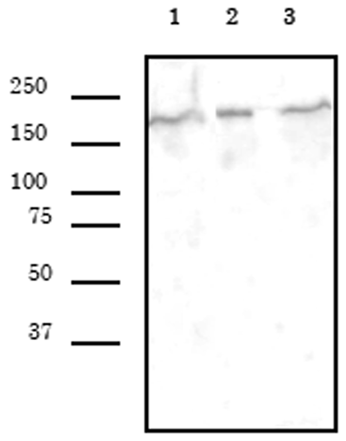 SMARCA4 antibody (mAb) (Clone 5B7) tested by Western blot. Whole cell extracts were probed with SMARCA4 antibody (mAb). Lane 1: L929 cells. Lane 2: HeLa cells. Lane 3: Cos cells