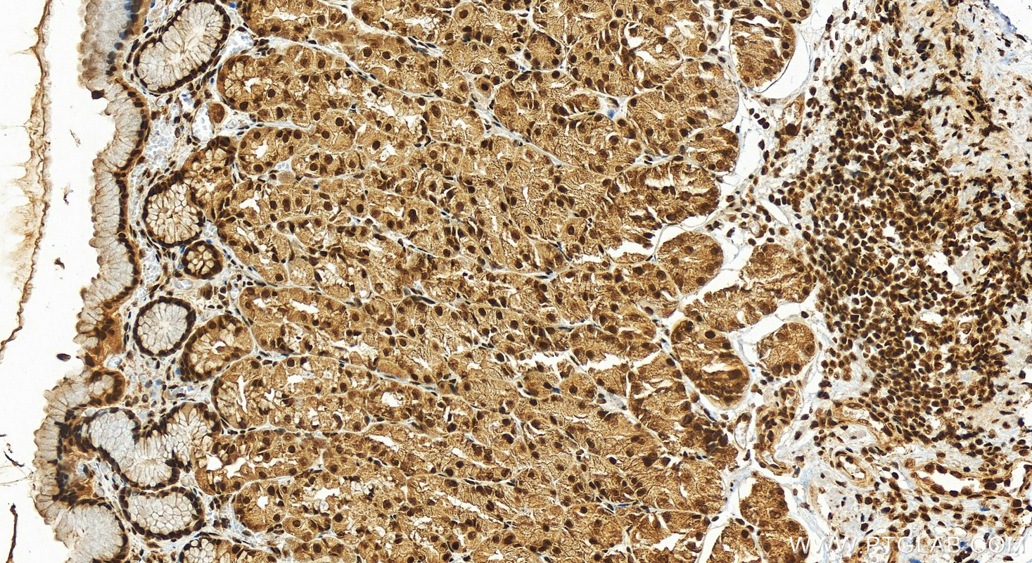 Immunohistochemistry (IHC) staining of human stomach tissue using SMARCA5 Polyclonal antibody (13066-1-AP)