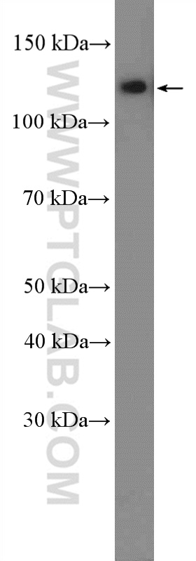 Western Blot (WB) analysis of HeLa cells using SMARCA5 Polyclonal antibody (13066-1-AP)