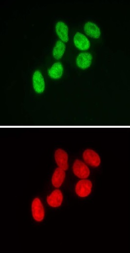 SMARCB1 antibody (mAb) (Clone 2C2) tested by immunofluorescence. Top: HeLa cells stained with SMARCB1 antibody (mAb). Bottom: Hoechst staining.