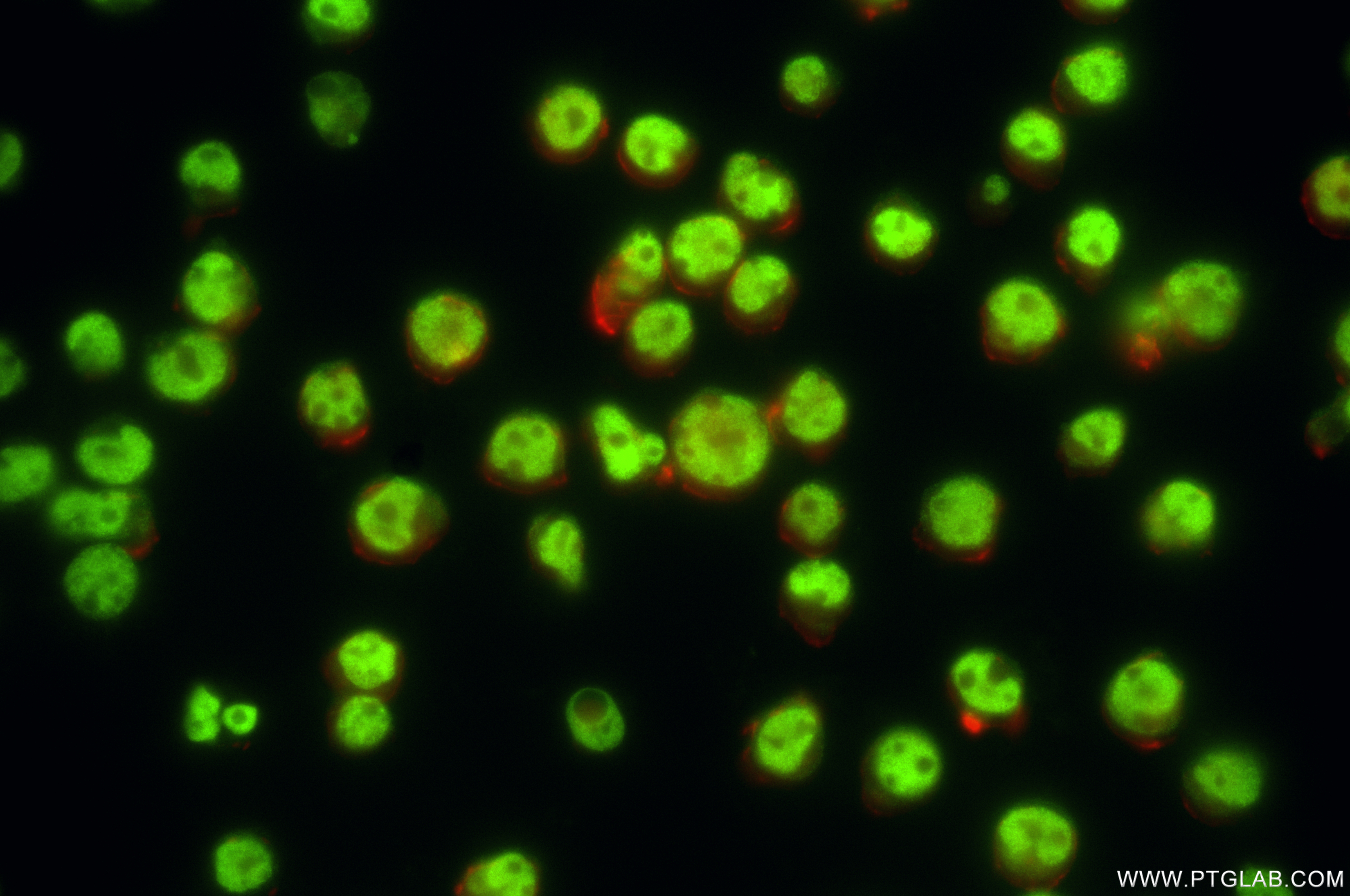 Immunofluorescence (IF) / fluorescent staining of Jurkat cells using SMARCC1 Recombinant antibody (86015-1-RR)