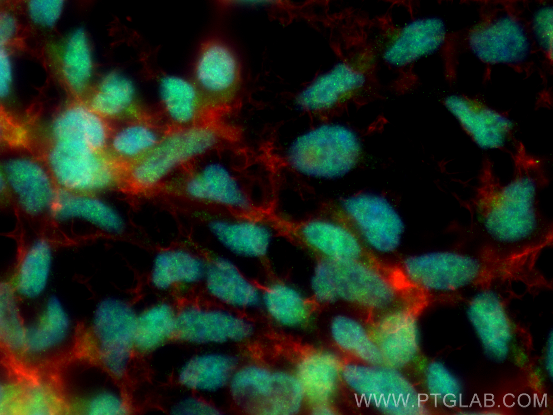 Immunofluorescence (IF) / fluorescent staining of HEK-293 cells using SMARCE1 Monoclonal antibody (66182-1-Ig)