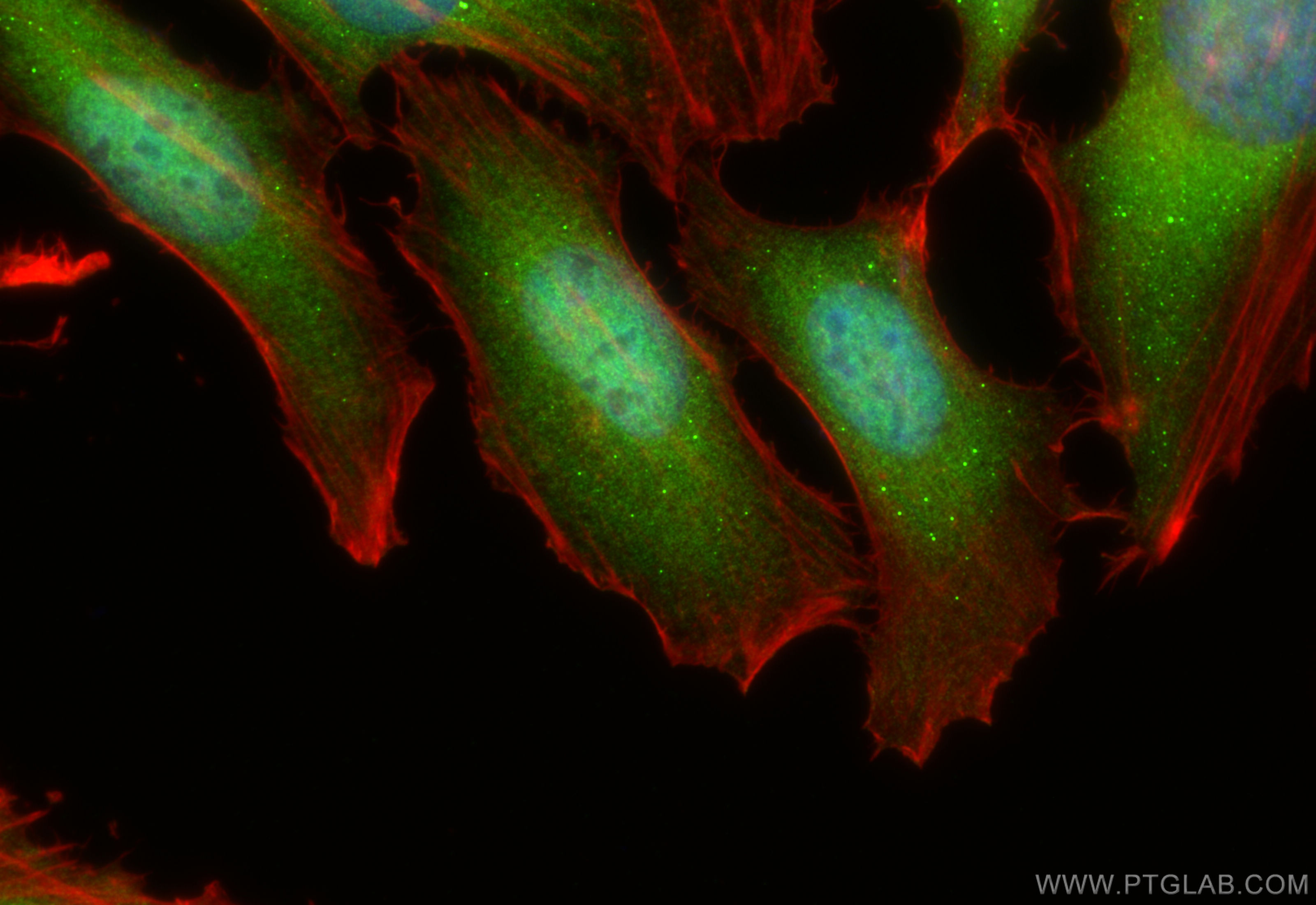 Immunofluorescence (IF) / fluorescent staining of HeLa cells using SMC2 Polyclonal antibody (30707-1-AP)