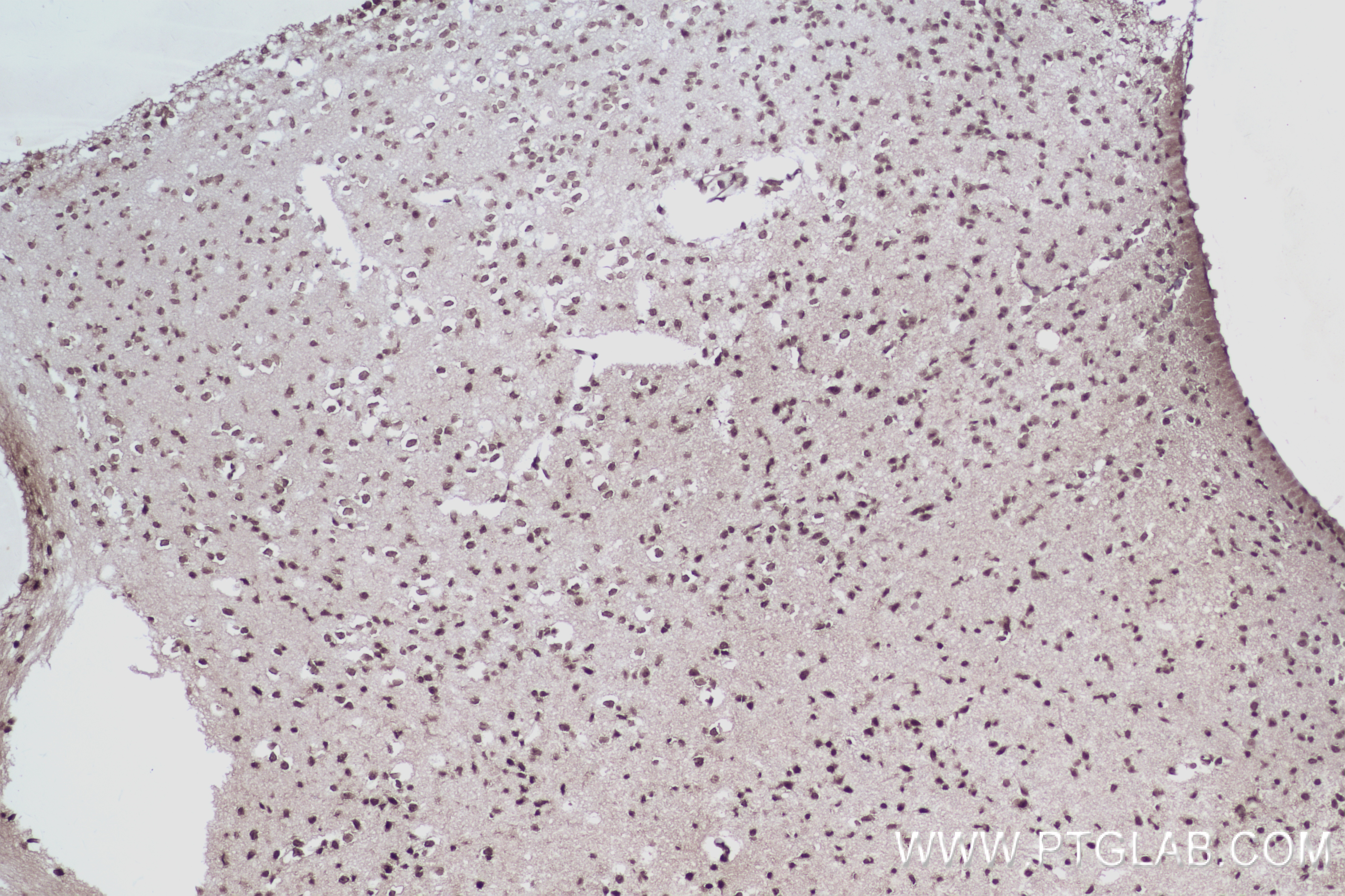 Immunohistochemistry (IHC) staining of mouse brain tissue using SMC2 Recombinant antibody (84835-1-RR)