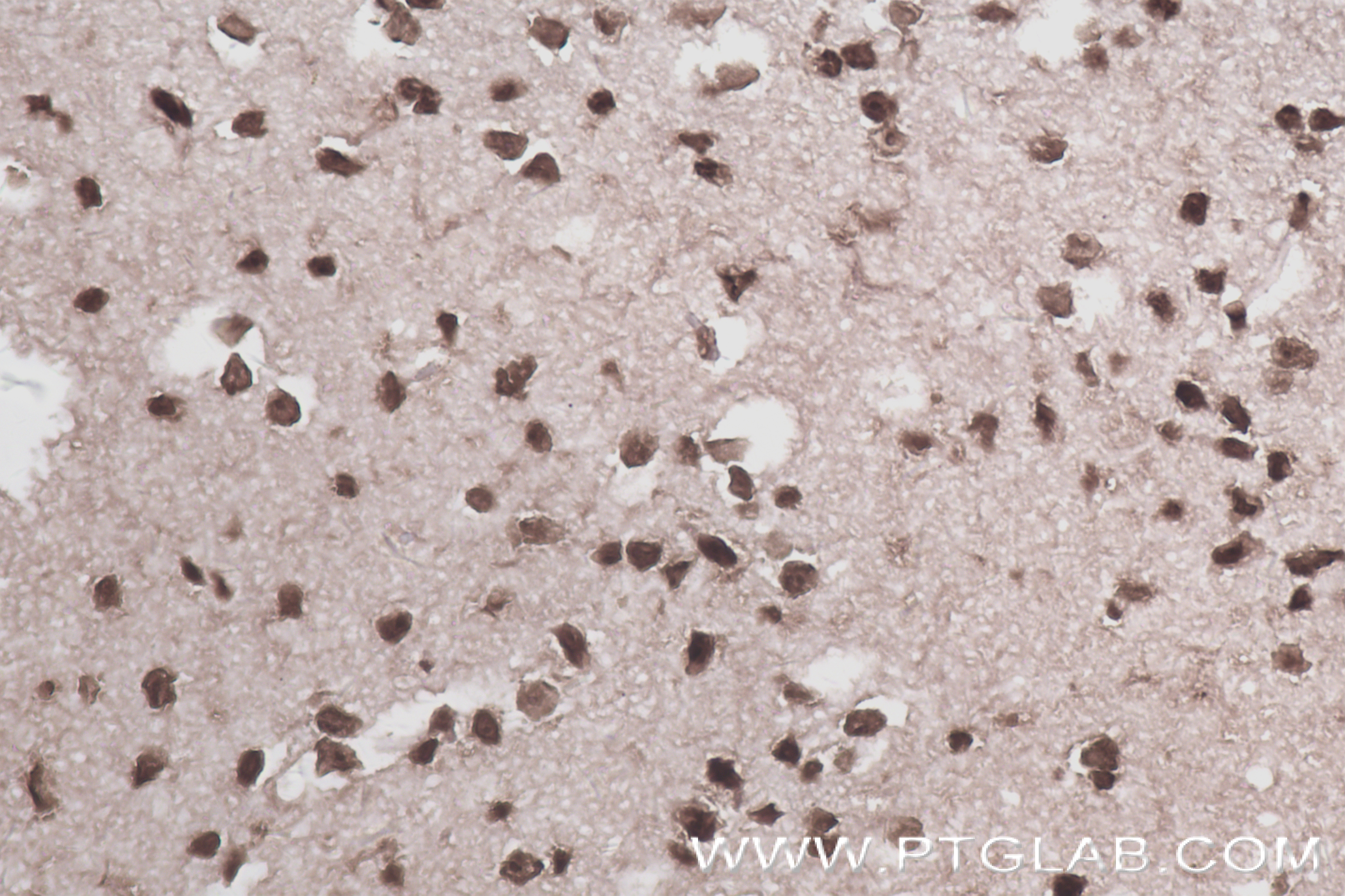 Immunohistochemistry (IHC) staining of mouse brain tissue using SMC2 Recombinant antibody (84835-1-RR)