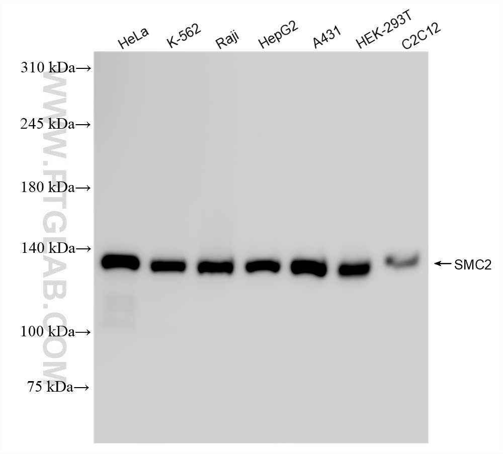 Western Blot (WB) analysis of various lysates using SMC2 Recombinant antibody (84835-2-RR)