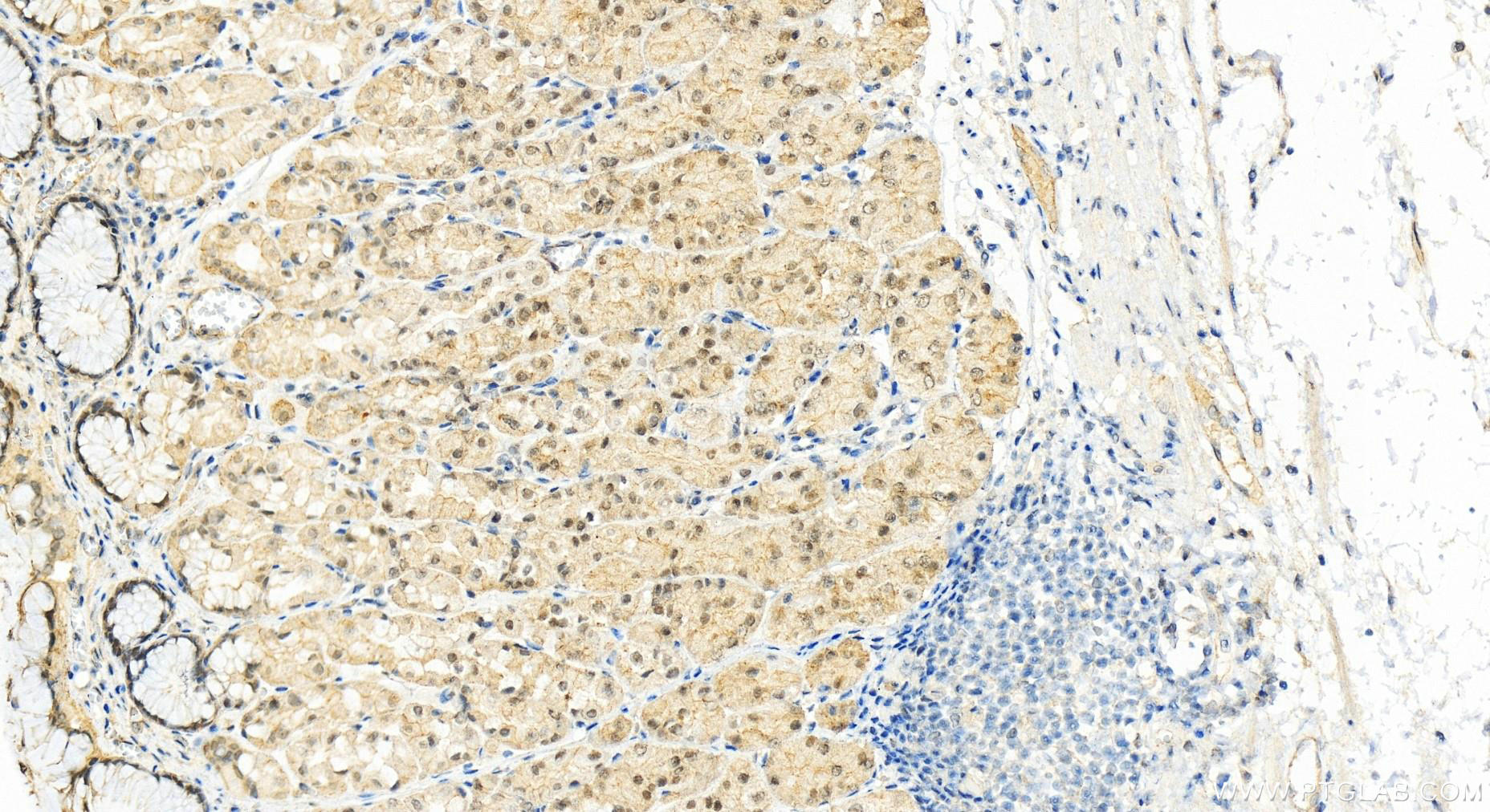 Immunohistochemistry (IHC) staining of human stomach tissue using SMC3 Polyclonal antibody (14185-1-AP)