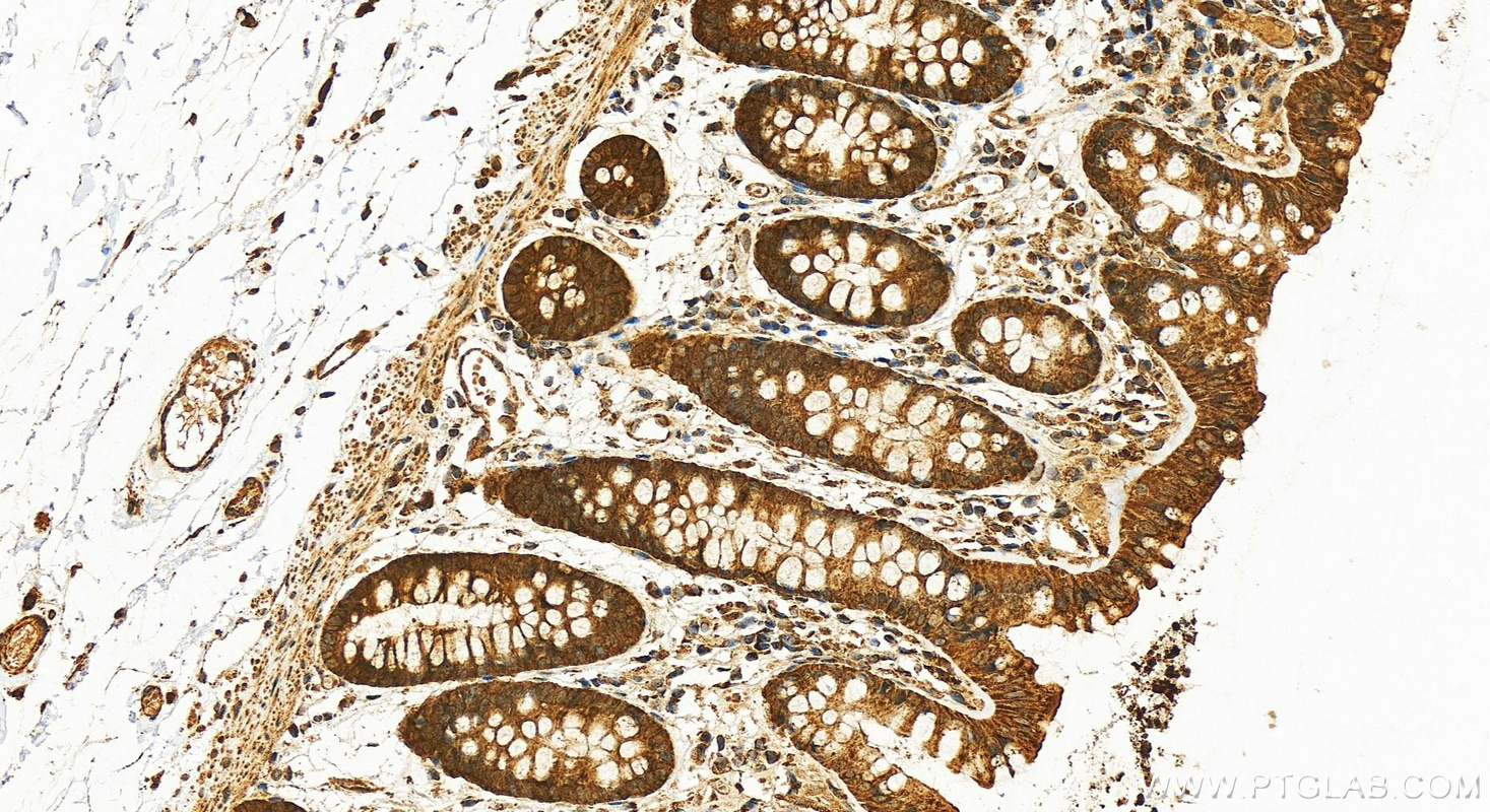 Immunohistochemistry (IHC) staining of human colon tissue using SMC4 Polyclonal antibody (24758-1-AP)