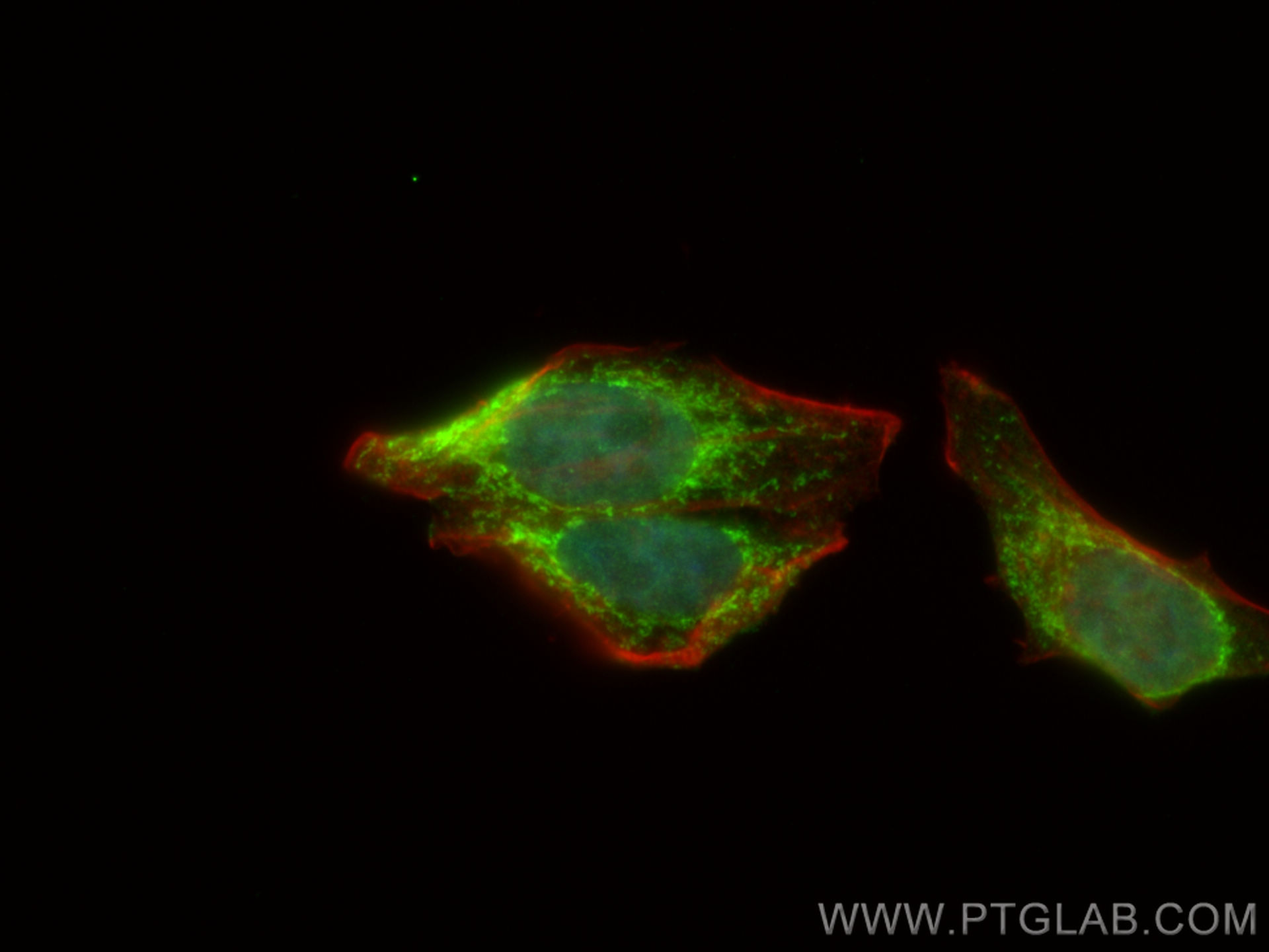 Immunofluorescence (IF) / fluorescent staining of HepG2 cells using SMC4 Polyclonal antibody (24758-1-AP)