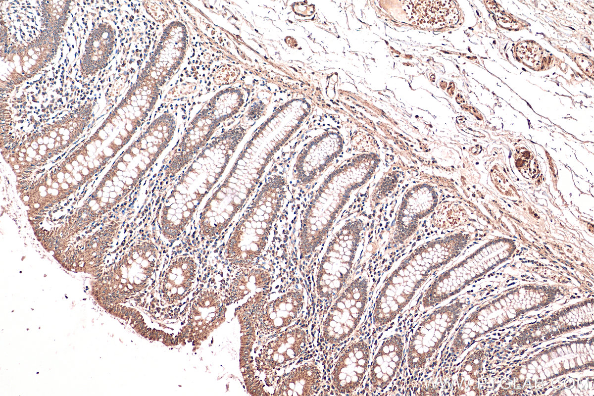 Immunohistochemistry (IHC) staining of human colon tissue using SMC4 Polyclonal antibody (24758-1-AP)