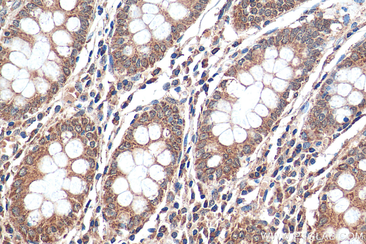 Immunohistochemistry (IHC) staining of human colon tissue using SMC4 Polyclonal antibody (24758-1-AP)