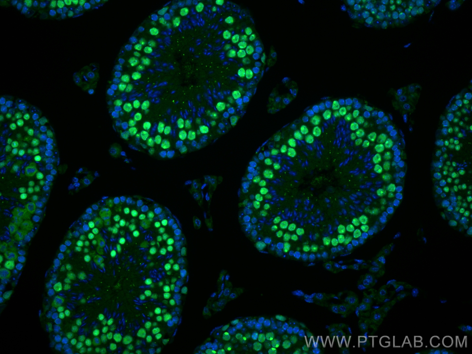 Immunofluorescence (IF) / fluorescent staining of mouse testis tissue using SMC6 Recombinant antibody (83187-3-RR)